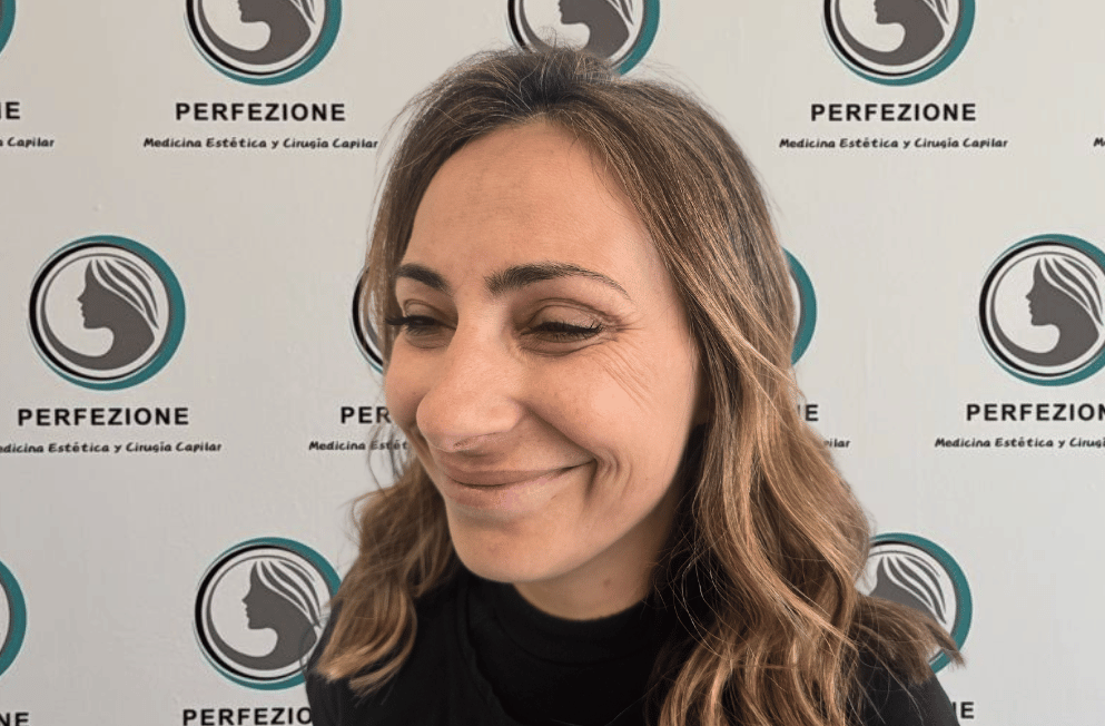 aplicacion-botox-frente-perfezione (2)