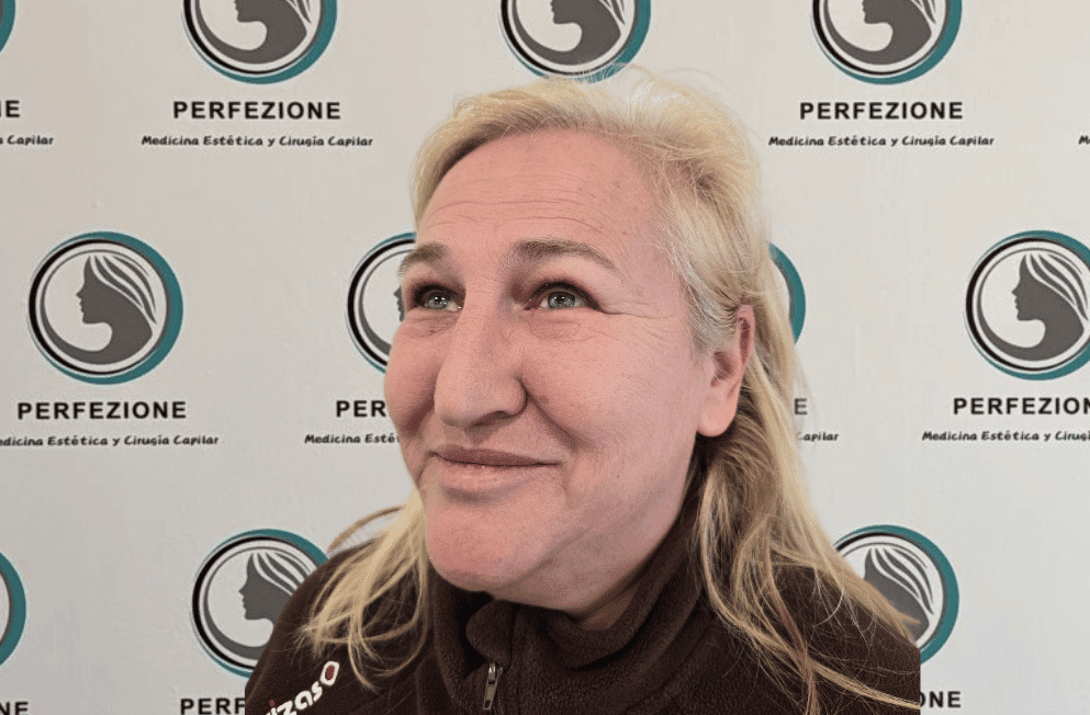 aplicacion-botox-frente-perfezione (5)