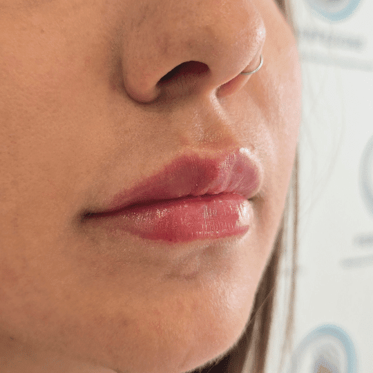 codigo-barras-labios-tratamiento-perfezione (2)