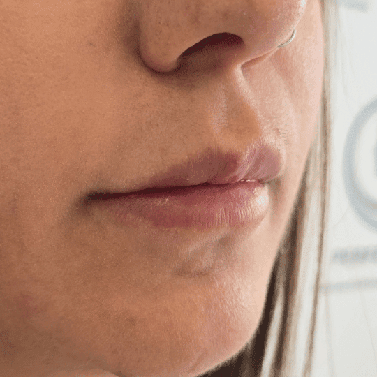 codigo-barras-labios-tratamiento-perfezione (3)