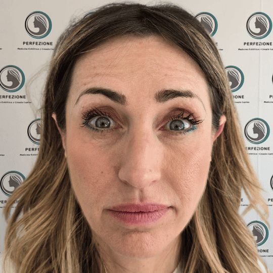 codigo-barras-labios-tratamiento-perfezione (4)