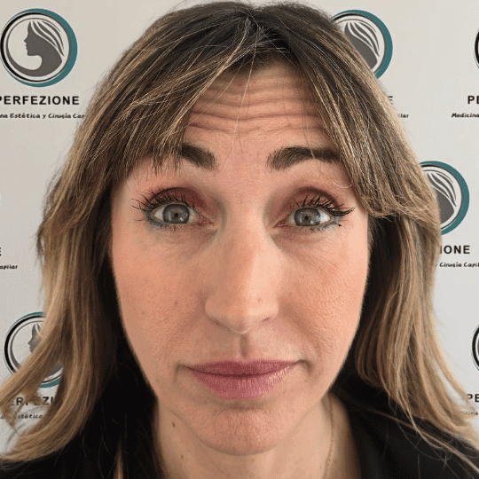 codigo-barras-labios-tratamiento-perfezione (5)