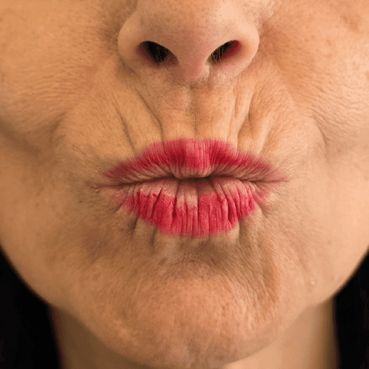 codigo-barras-labios-tratamiento-perfezione (6)