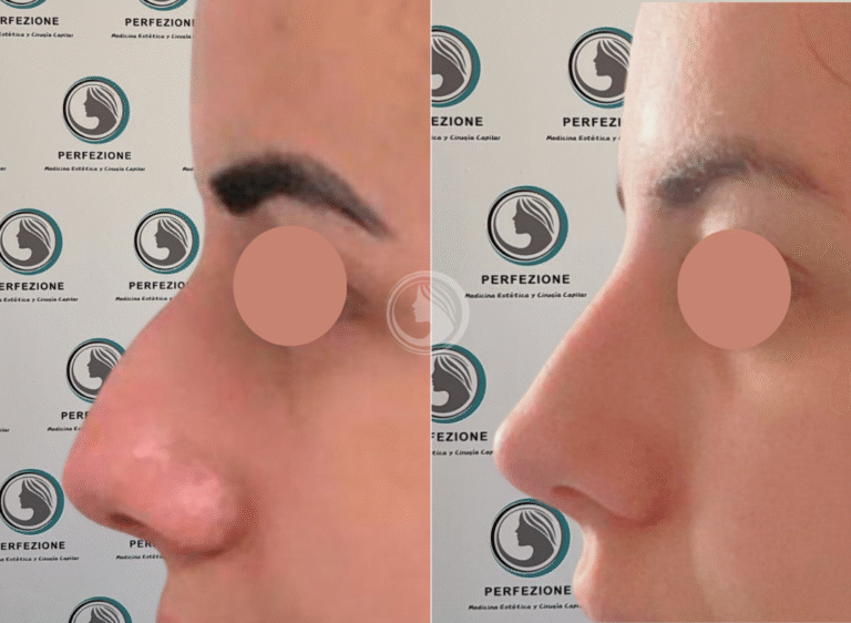 Site Perfezione Rinomodelacion