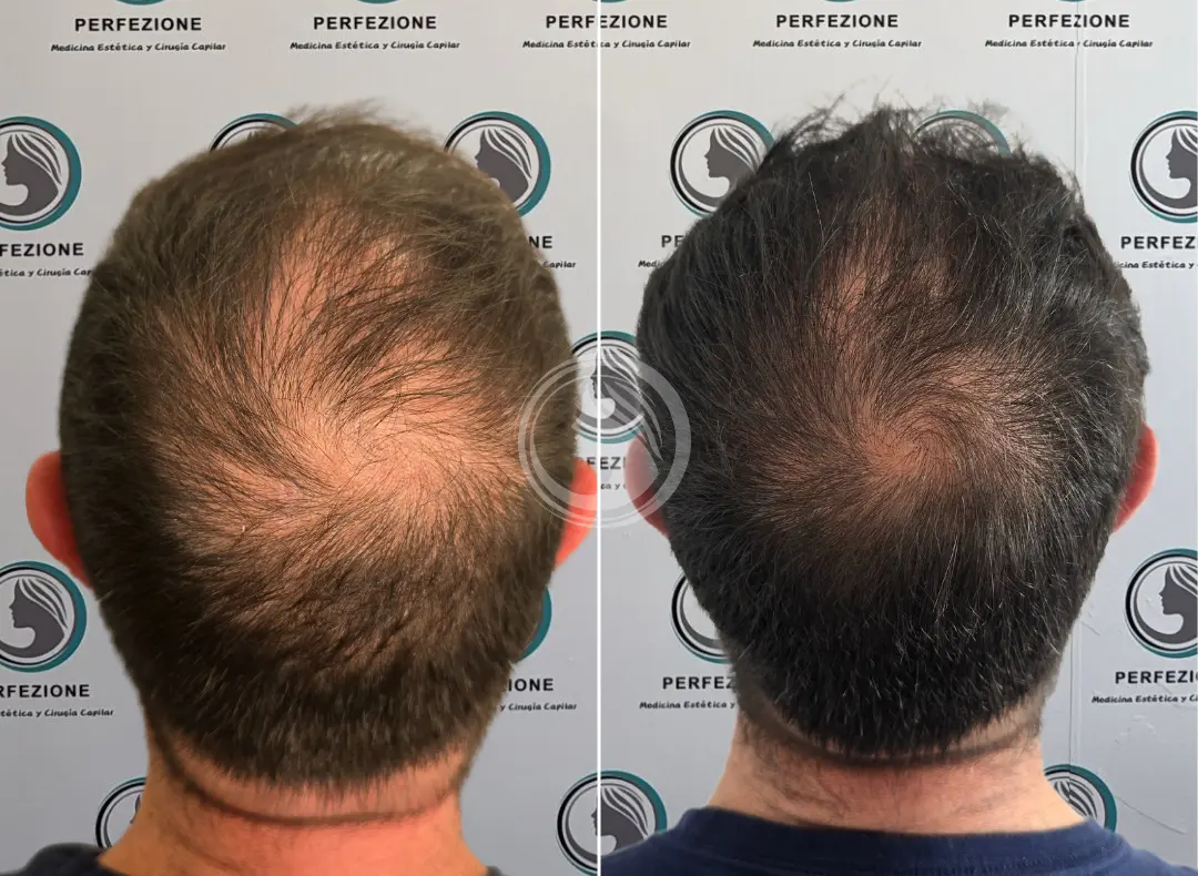 antes despues cellbooster vitaminas hombre getafe perfezione.webp