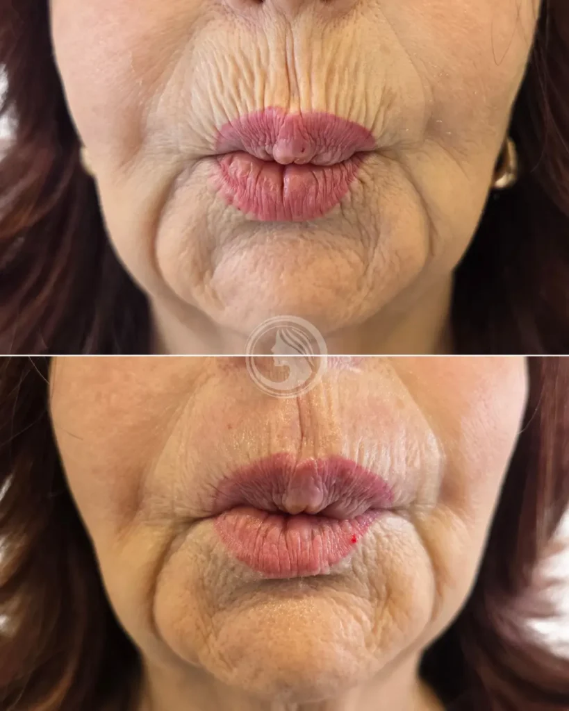 perfezione clinic relleno codigo de barras.wpeg