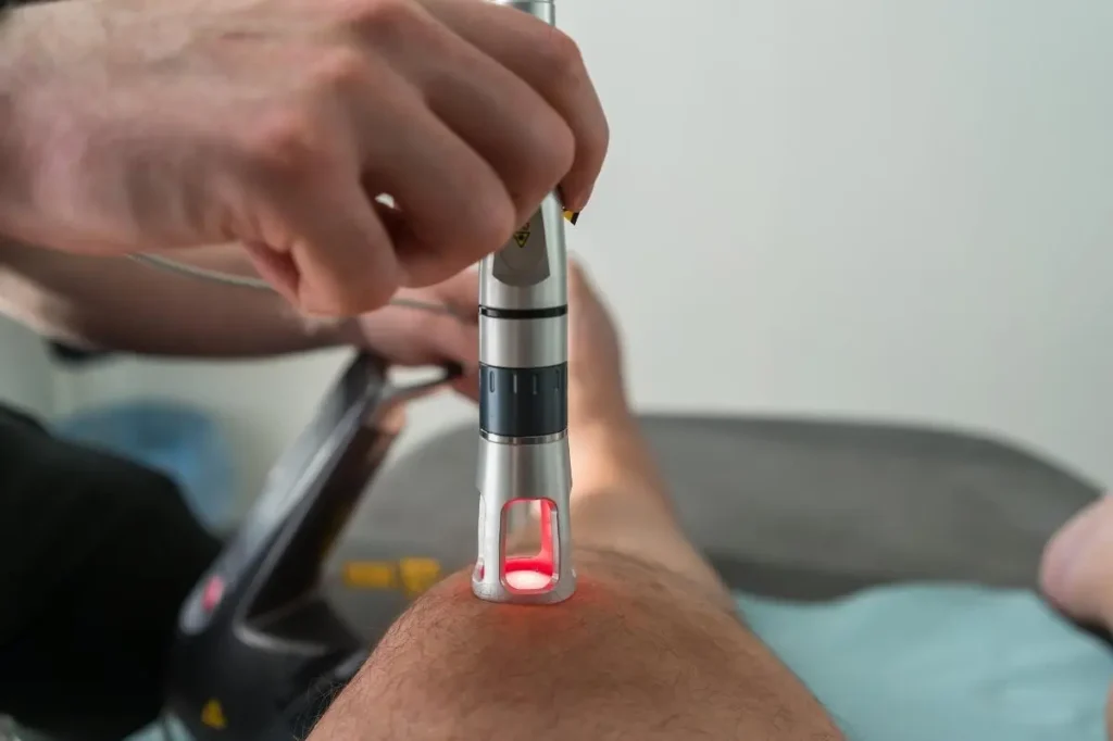 rejuvenecimiento facial con k laser.webp