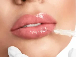Russian Lips vs relleno de labios tradicional: diferencias clave