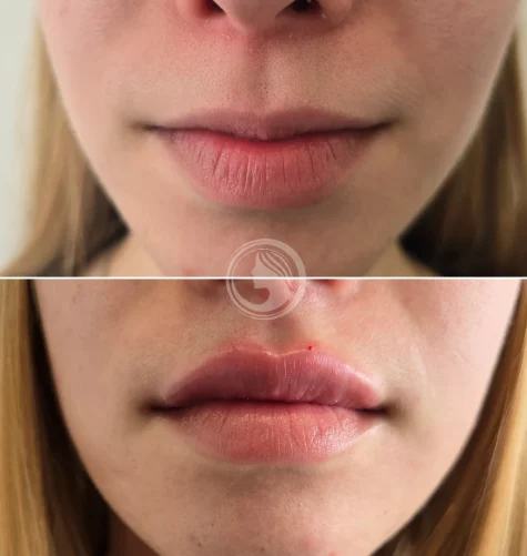 labios-hidratados-y-definidos-russian-lips.webp