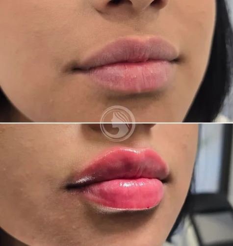 Hidratación y volumen equilibrado en labios.